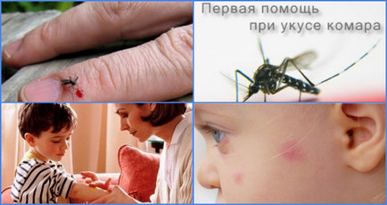 A dolgok kend (szúnyogcsípés egy gyermek) szúnyogcsípés gyermek Mit kell kend szúnyogcsípés gyermek