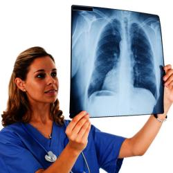 Mi a beszivárgás a tüdő okok, típusok és kezelések
