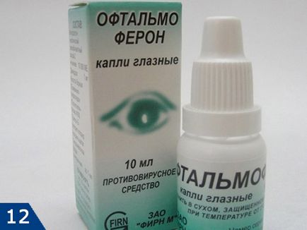 Herpesz a szemet - fotók, hatékony terápia a komplikációk elkerülése érdekében