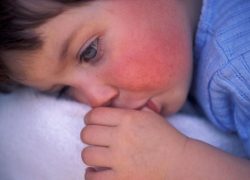 A lappangási idő a mandulagyulladás gyermekeknél