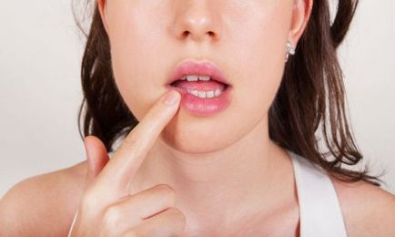 Hogyan kell kezelni allergiás ajkak