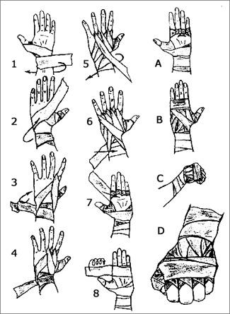 Hogyan kötést kezét Ökölvívás - cikkek - szovjet Sport
