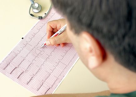 Hogy van az EKG és hogyan kell felkészülni - szól a magas vérnyomás és annak kezelése