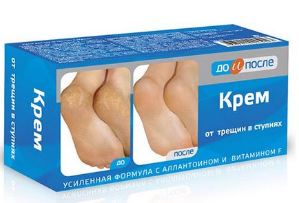 Foot Cream - hogyan válasszuk ki