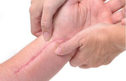 Kenőcs hegek melyik eszközt választani (kenőcs) Kenőcs hegek melyik eszközt választani