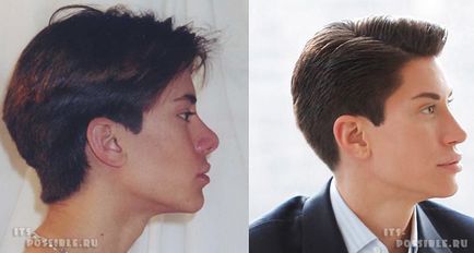 Alive baba ken és Barbie (Justin Jedlica plasztikai sebészet) Alive babák Barbie és Ken