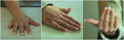 Az ortopéd ujjak - kéz- és lábujjak
