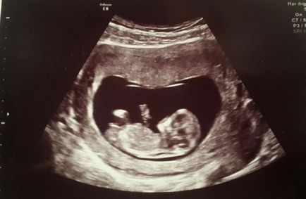 Dekódolása ultrahang terhesség alatt rövidítések, adatok, tanúvallomások