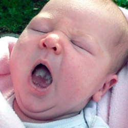Stomatitis csecsemők - kezelése a gyermek a hazai