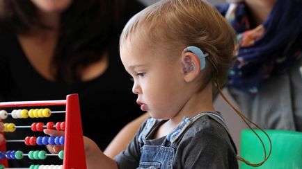 A halláskárosodás gyermekeknél - tünetei és kezelése süketség gyermekeknél