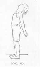 Gyakorlatok vydvigateley mandibula fogpótlás (gyakorlatok) Gyakorlatok vydvigateley állcsont fogpótlás