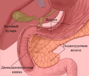 Mi pancreatitis a hasnyálmirigy