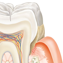 periodontitis fokozat