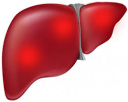 Hepatitis hogy lehet enni Hepatitis hogy lehet enni