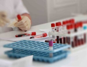 vér biokémiai a máj kezelésére és dekódolására az alapvető mutatók