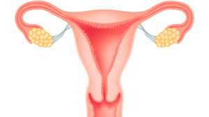 Uzi endometriózis