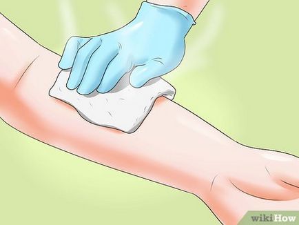 Hogyan készítsünk magának az injekciót intravénásan