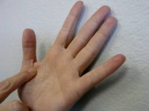 Viszkető jobb kéz, hogy mit Viszkető jobb kéz, hogy mit