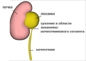 Vesemedence mi ez Vesemedence mi ez