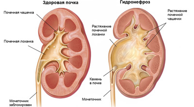 Vesemedence mi ez Vesemedence mi ez