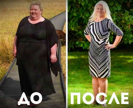 Történetében, aki mindkét lefogyott Történetében, aki mindkét lefogyott