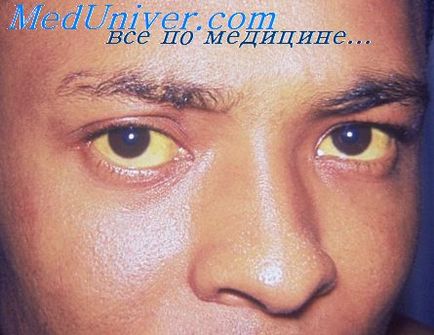 Hepatitis hogyan Hepatitis hogyan