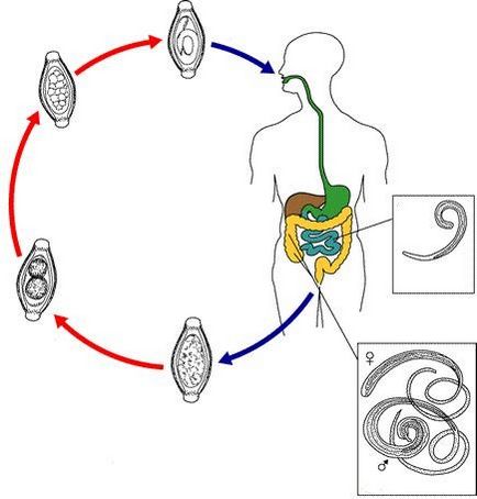 Trichocephalosis meg