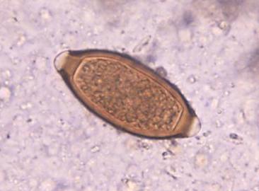 Trichocephalosis meg