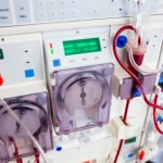 Az ára hemodialízis