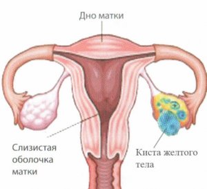Mi a sárgatest ultrahanggal Mi a sárgatest ultrahanggal