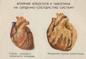 Alkohol és annak káros hatásai az emberi egészségre, az agy, a szív, a máj és egyéb szervek (káros) Alkohol és annak káros hatásai az emberi egészségre, az agy, a szív, a máj és egyéb szervek