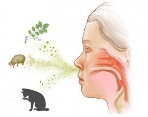 Allergiás bronchitis tünetei és kezelése felnőttek és gyermekek
