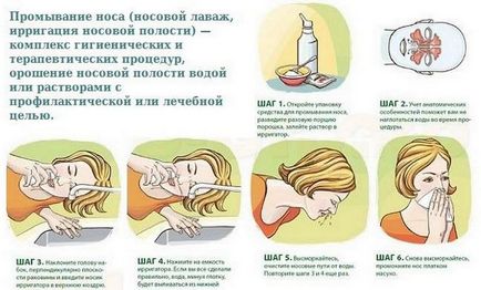 Hogyan és mit kell mosni az orr-garat otthon megfelelően öblítse orrgarat