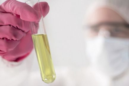 Mit citoplazmában (Golgi-készülék) Mit citoplazmában