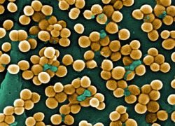 Hogyan kell kezelni a staphylococcus