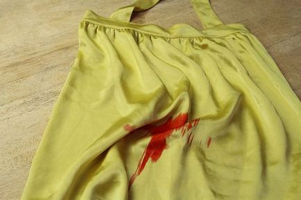 Hogyan mossa a vért a ruhát otthon