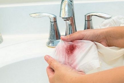 Hogyan mossa a vért a ruhát otthon