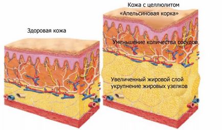 Hogyan lehet fogyni a menopauza idején gyorsan és tartósan módszerek és eszközök