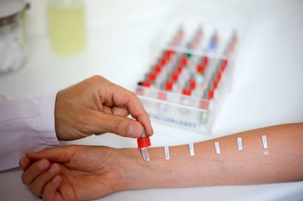 Hogyan kell kezelni az allergiás köhögés (élvezet) Hogyan kell kezelni az allergiás köhögés
