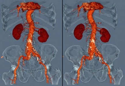 MRI kontraszt - mi ez, jelzések és korlátozásokat, hogy végre