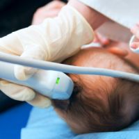 Újszülött Neurosonography (neurosonography) neurosonography újszülöttek