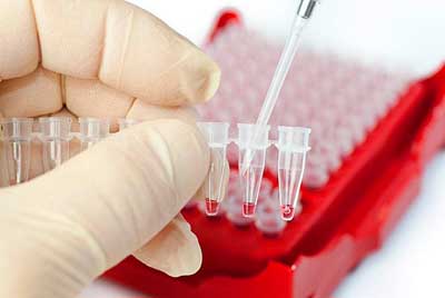 Élelmiszer növeli a vér hemoglobin (megnövekedett) Élelmiszer növeli a vér hemoglobin