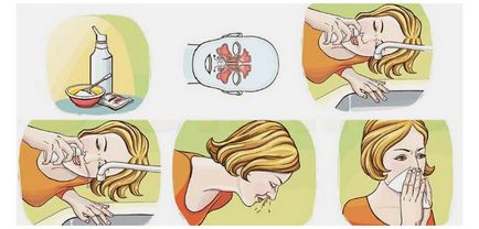 Az orr öblítés - hogyan kell tisztítani otthon