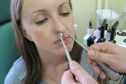 Helyezze át a orrcsont áthelyezésére technikák orr törés után