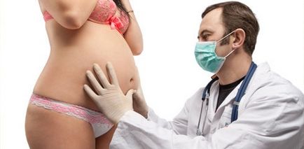 Nemzetségek egy keskeny medence (keskeny) Nemzetségek szűk medence