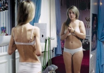 Hányás, fogyás - az első lépés az anorexia, fogyni könnyen (az első) Hányás, fogyás - az első lépés az anorexia, fogyni könnyen