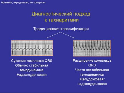 Tachyarrhythmia mi ez, okai, tünetei és kezelése