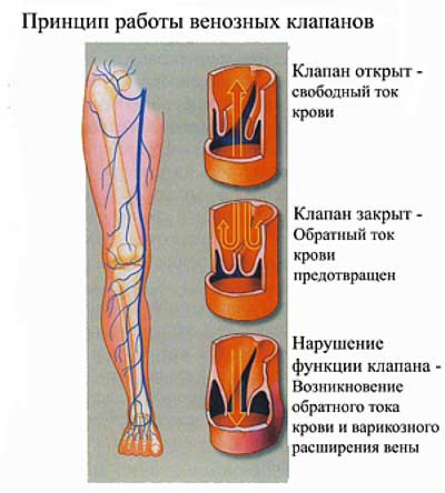 Vénás a vér pangását a lábak, a fej és a tüdő