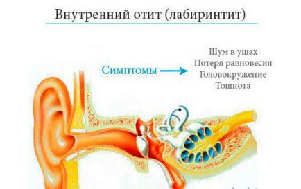 Болести на ухото на възрастни симптоми и лечение, болестта на ухото