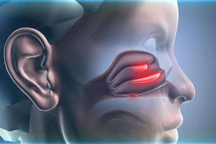 Какво е септопластика и rhinoseptoplasty